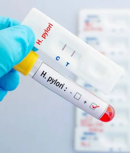 Como-Detectar-que-Tienes-la-Bacteria-Helicobacter-pylori