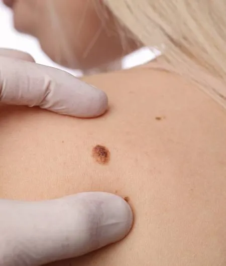 phtkzpduxluihs5pxfnccld8umbb3azm